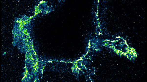 WashU chemists develop groundbreaking test to track crucial edits to RNA